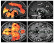 In Hong et al. (2009), fMRI scans indicate widespread activation in the brain during REM sleep.  Left panels indicate areas with statistically significant activity (colored) from sagittal and horizontal sections.  Supplementary right panels provide reference for anatomical regions of interest, e.g. OG=occipital gyrus (for vision); ST=superior temporal gyrus (for hearing, language); GP, Pu, Cd= Globus Pallidus, Putamen, Caudate Nucleus (for voluntary motor control). 
