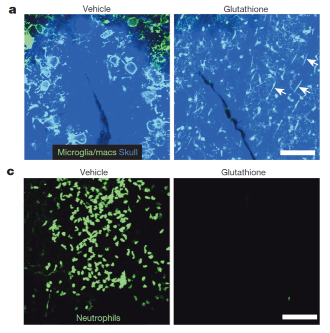 Figure Roth et al. (2014) showing a substantially decreased immune response to a concussion when treated with the antioxidant glutathione.