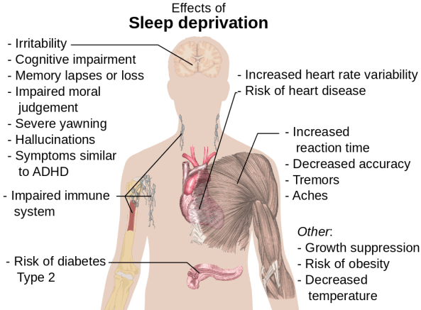 1024px-Effects_of_sleep_deprivation.svg