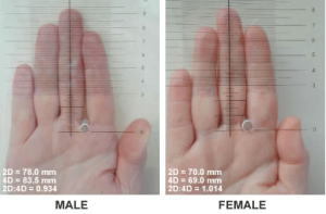 Comparison of typical 2D (2nd finger) to 4D (4th finger) ratios in a male and female. Women with CAH will have 2D:4D ratios, as well as behavioral attributes, that are more stereotypically masculine than women without CAH.
