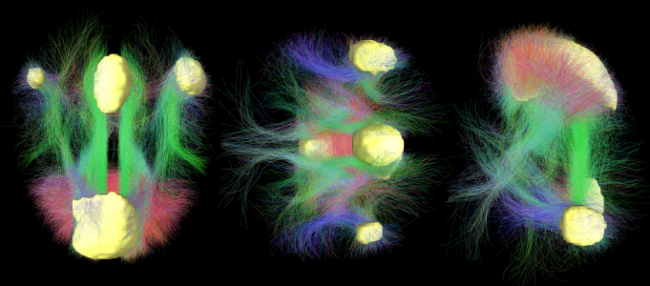 Default_Mode_Network_Connectivity