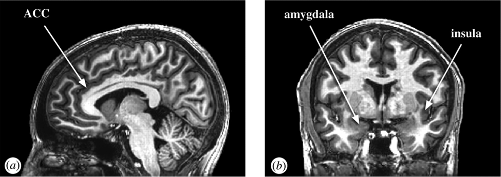 Cardunculus Brain Left Brain, Right Brain, Red Brain, Blue Brain | NeuWrite San Diego