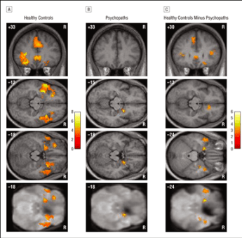 psychopathy fmri