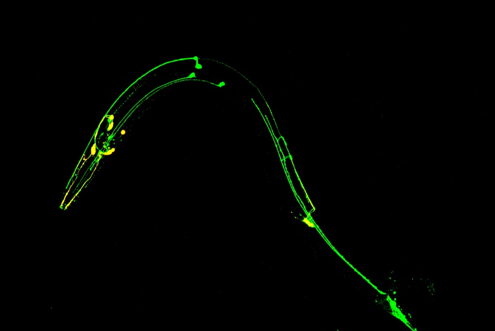 Genomes, Circuits, and the Roundworm: C. Elegans as a Model Organism ...