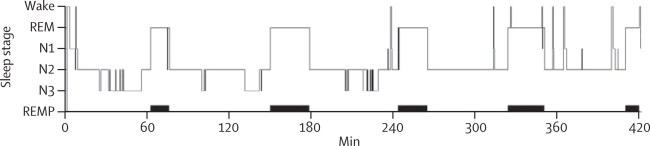 1-s2.0-S1474442212703228-gr2_lrg