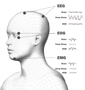 electrodepositions-01