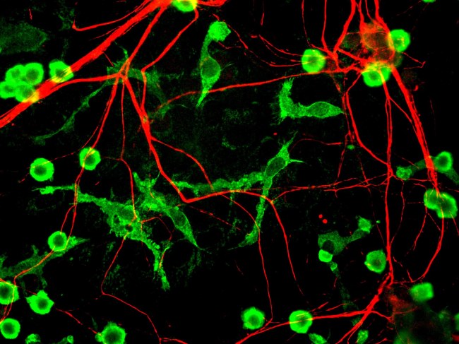 Microglia_and_neurons
